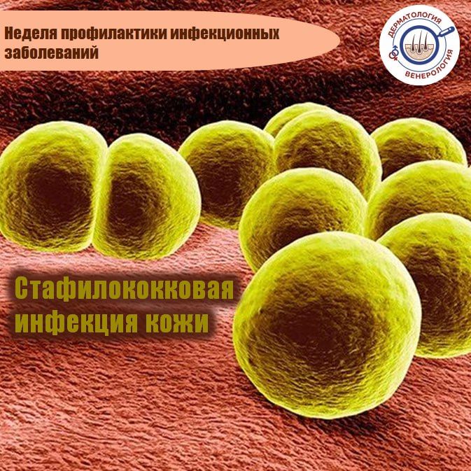       ,    Staphylococcus