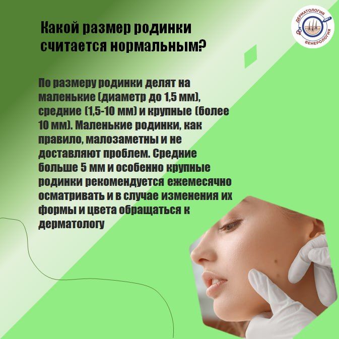 Первые родинки появляются ещё в детстве Первые родинки появляются ещё в детстве