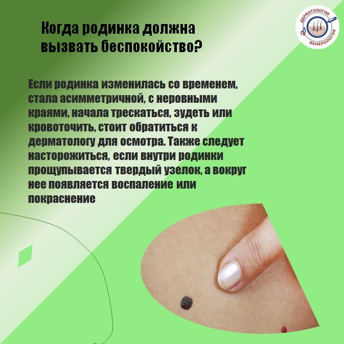 Первые родинки появляются ещё в детстве Первые родинки появляются ещё в детстве