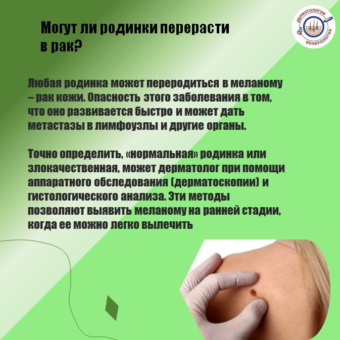 Первые родинки появляются ещё в детстве Первые родинки появляются ещё в детстве