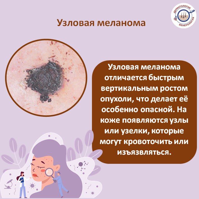 Меланома – это агрессивная форма рака кожи, которая может быстро распространяться и метастазировать Меланома – это агрессивная форма рака кожи, которая может быстро распространяться и метастазировать