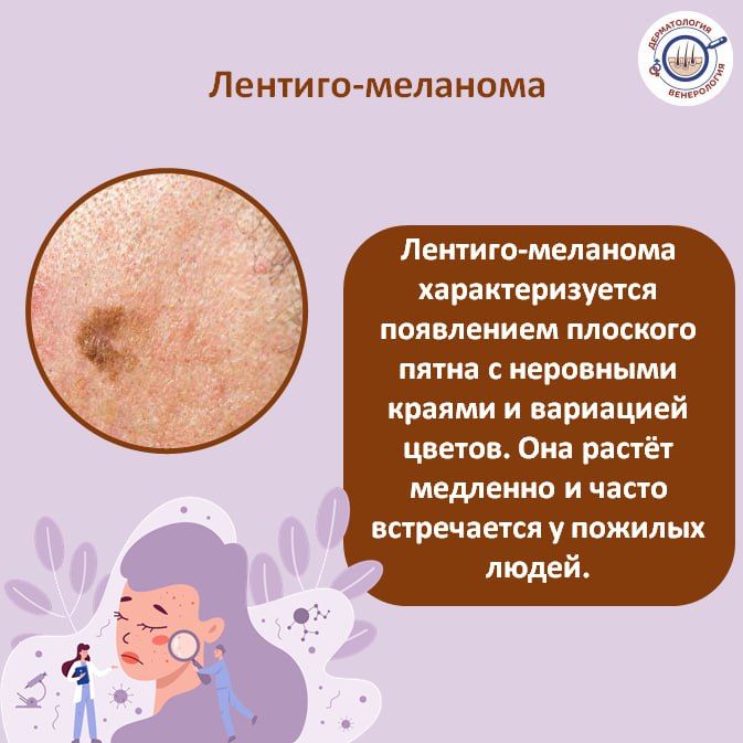 Меланома – это агрессивная форма рака кожи, которая может быстро распространяться и метастазировать Меланома – это агрессивная форма рака кожи, которая может быстро распространяться и метастазировать