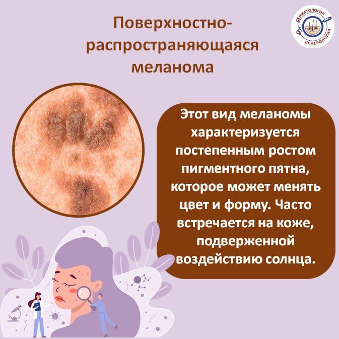 Меланома – это агрессивная форма рака кожи, которая может быстро распространяться и метастазировать Меланома – это агрессивная форма рака кожи, которая может быстро распространяться и метастазировать