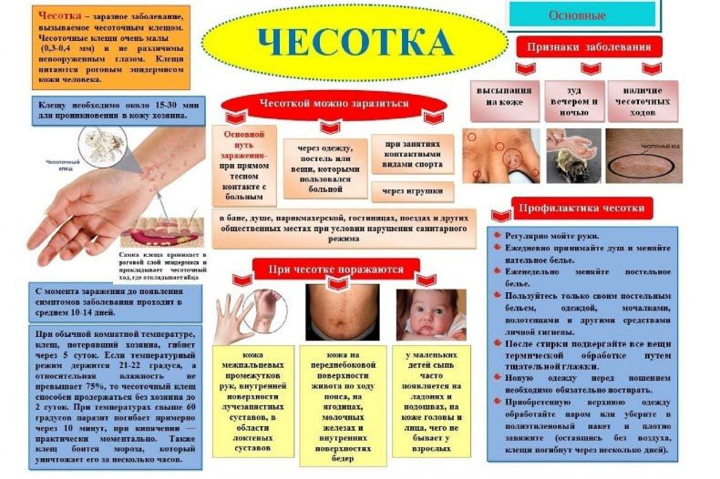 ЭНЦИКЛОПЕДИЯ ЗДОРОВЬЯ: Профилактика чесотки ЭНЦИКЛОПЕДИЯ ЗДОРОВЬЯ: Профилактика чесотки