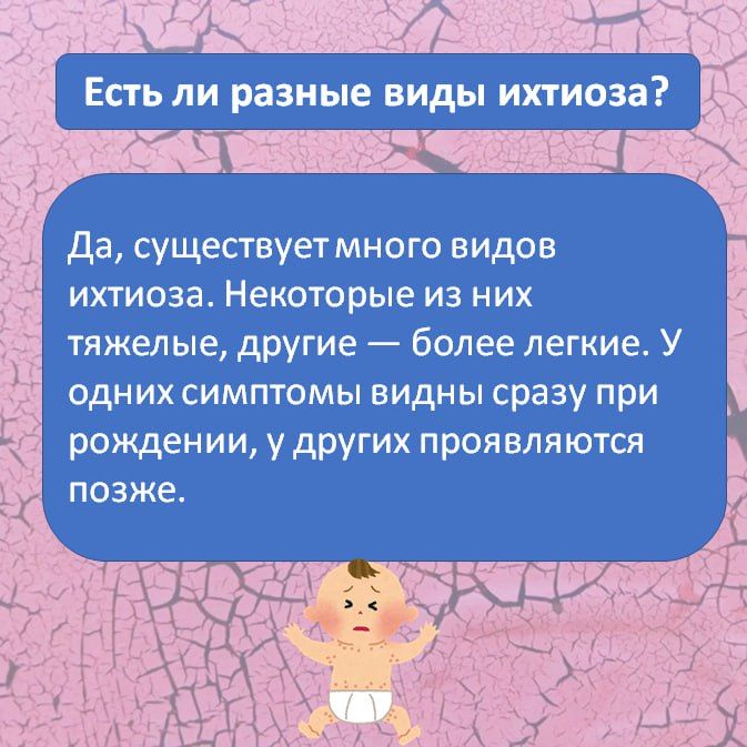 Ихтиоз — редкое генетическое заболевание кожи, при котором она становится очень сухой, толстой и покрывается чешуйками, похожими на рыбью чешую Ихтиоз — редкое генетическое заболевание кожи, при котором она становится очень сухой, толстой и покрывается чешуйками, похожими на рыбью чешую