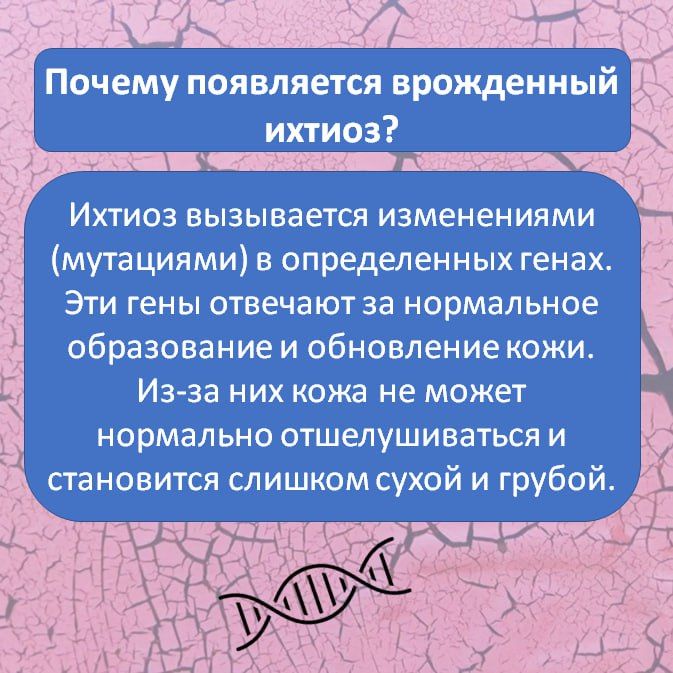 Ихтиоз — редкое генетическое заболевание кожи, при котором она становится очень сухой, толстой и покрывается чешуйками, похожими на рыбью чешую Ихтиоз — редкое генетическое заболевание кожи, при котором она становится очень сухой, толстой и покрывается чешуйками, похожими на рыбью чешую