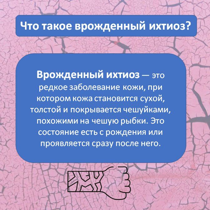 Ихтиоз — редкое генетическое заболевание кожи, при котором она становится очень сухой, толстой и покрывается чешуйками, похожими на рыбью чешую Ихтиоз — редкое генетическое заболевание кожи, при котором она становится очень сухой, толстой и покрывается чешуйками, похожими на рыбью чешую