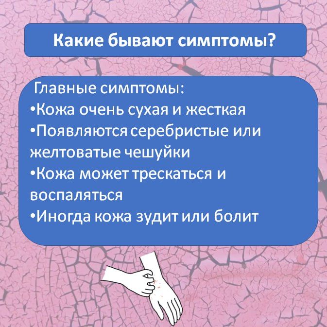 Ихтиоз — редкое генетическое заболевание кожи, при котором она становится очень сухой, толстой и покрывается чешуйками, похожими на рыбью чешую Ихтиоз — редкое генетическое заболевание кожи, при котором она становится очень сухой, толстой и покрывается чешуйками, похожими на рыбью чешую