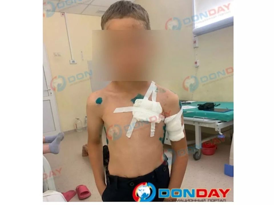 Волк-питомец покалечил 8-летнего мальчика в Гуково Волк-питомец покалечил 8-летнего мальчика в Гуково