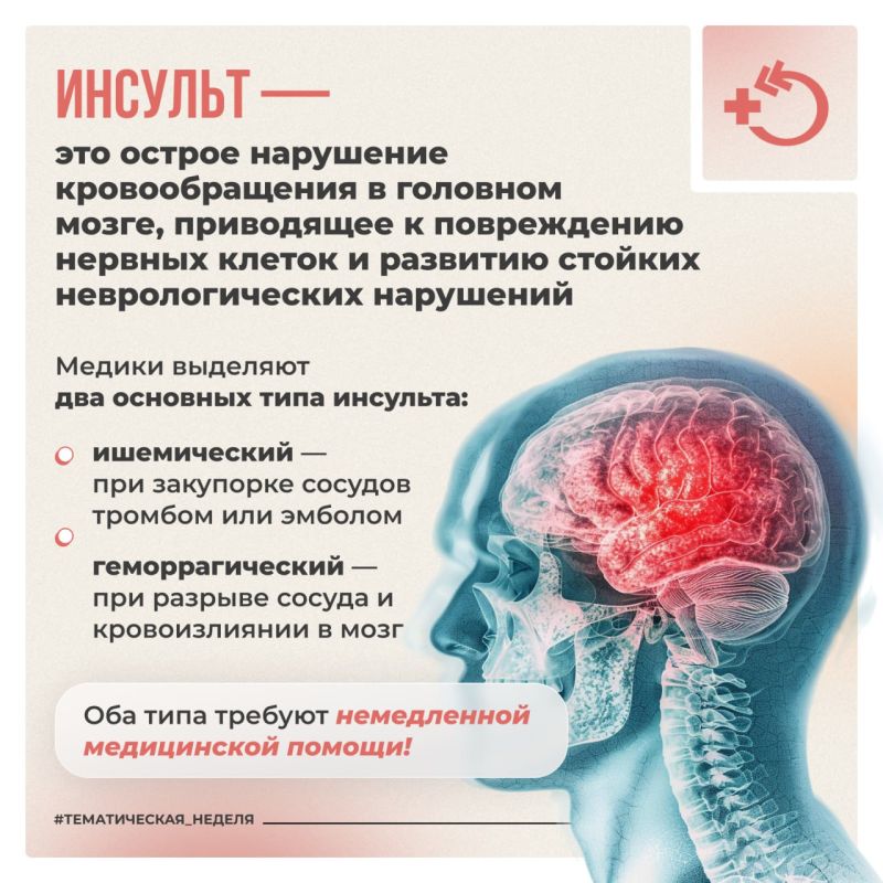 29 октября – Всемирный день борьбы с инсультом 29 октября – Всемирный день борьбы с инсультом