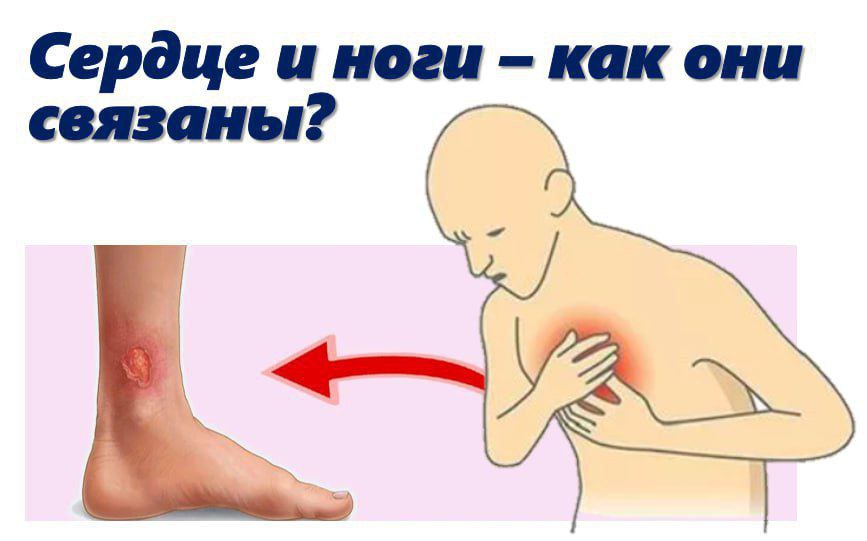 СЕРДЦЕ И НОГИ: КАК ОНИ СВЯЗАНЫ?