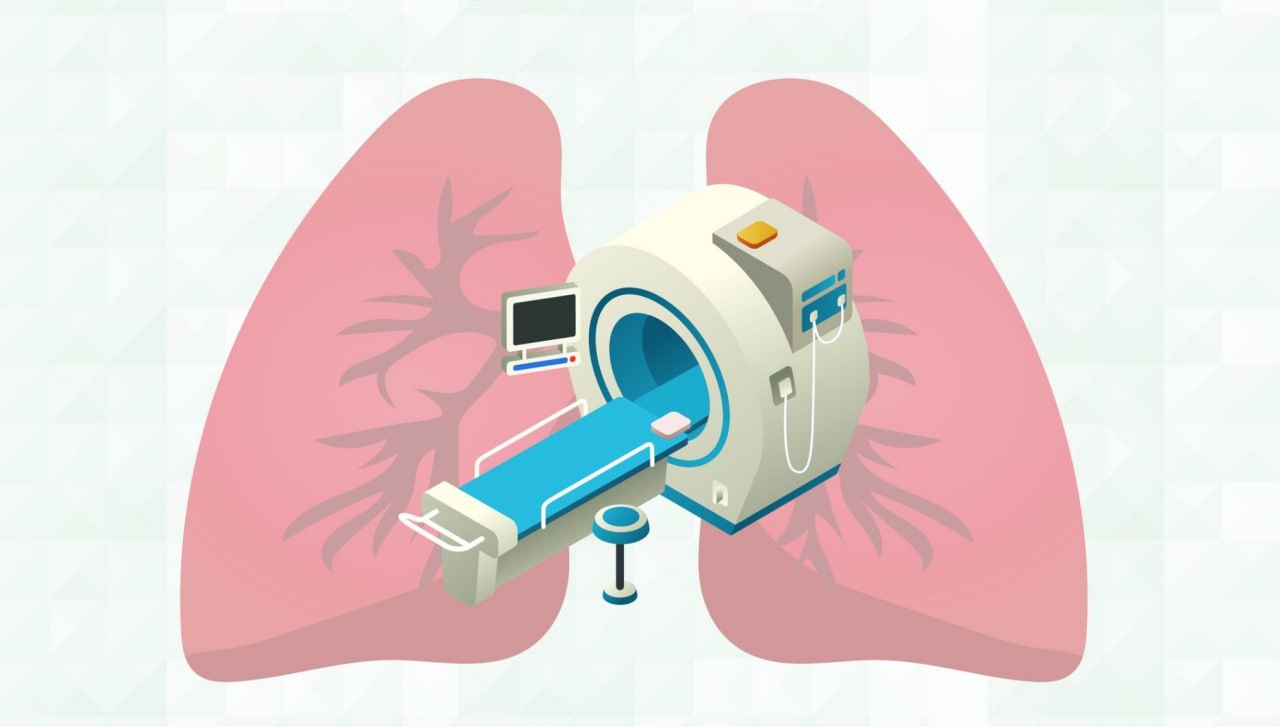 Зачем нужен скрининг рака легких?