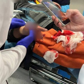 В Подмосковье ребёнок нашёл на детской площадке монету, внутри которой оказалась взрывчатка