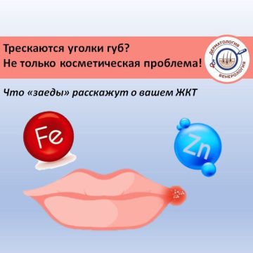 Сегодня в рамках недели профилактики ЖКТ поговорим о маленькой, но очень неприятной проблеме, с которой сталкивался почти каждый — о «заедах» (или по-научному ангулярный хейлит)