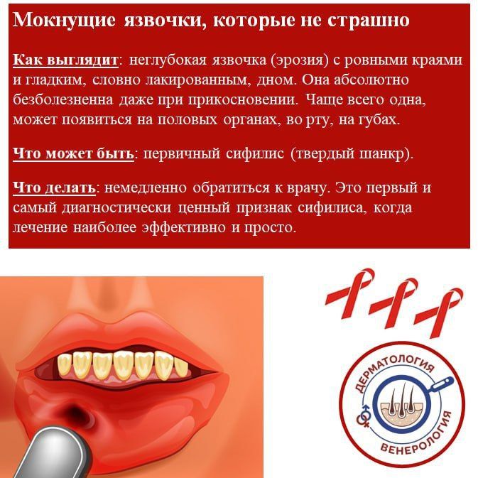 Сыпь «как аллергия»: 4 сигнала на коже, которые нельзя лечить таблетками от зуда Сыпь «как аллергия»: 4 сигнала на коже, которые нельзя лечить таблетками от зуда