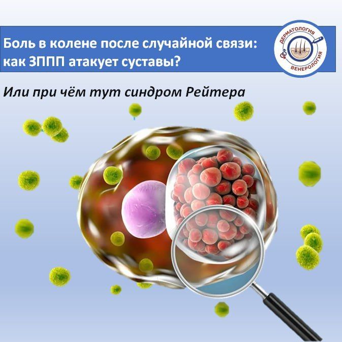 Представьте: через пару недель после отпуска (или мимолетного знакомства) у вас вдруг резко начинает болеть колено, опухает лодыжка, а подъем по лестнице превращается в пытку