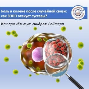 Представьте: через пару недель после отпуска (или мимолетного знакомства) у вас вдруг резко начинает болеть колено, опухает лодыжка, а подъем по лестнице превращается в пытку