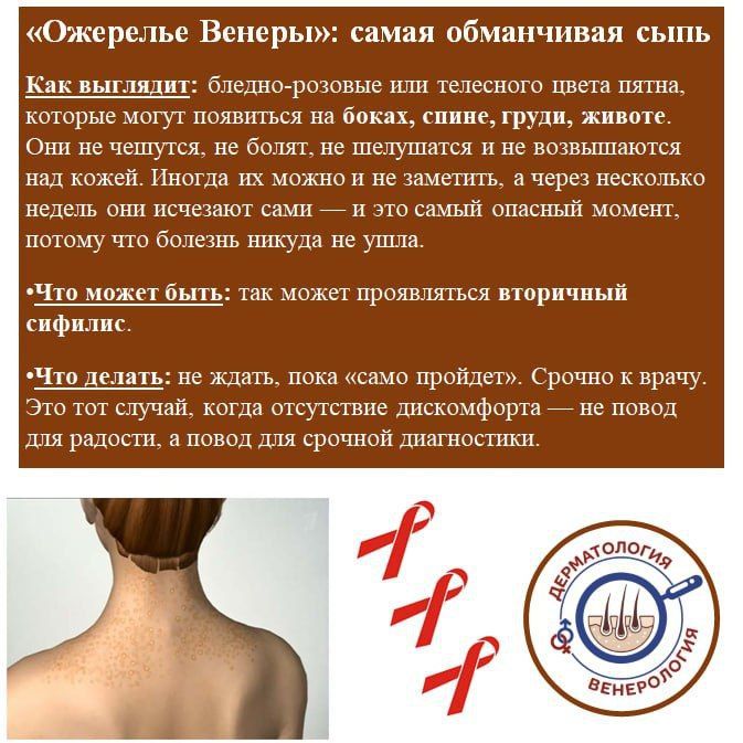 Сыпь «как аллергия»: 4 сигнала на коже, которые нельзя лечить таблетками от зуда