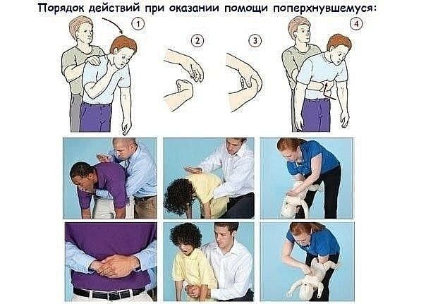 ЧТО ДЕЛАТЬ ЕСЛИ ЧЕЛОВЕК ПОДАВИЛСЯ ЧТО ДЕЛАТЬ ЕСЛИ ЧЕЛОВЕК ПОДАВИЛСЯ