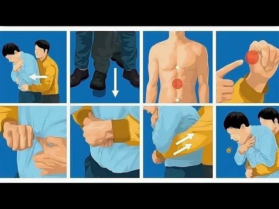 ЧТО ДЕЛАТЬ ЕСЛИ ЧЕЛОВЕК ПОДАВИЛСЯ ЧТО ДЕЛАТЬ ЕСЛИ ЧЕЛОВЕК ПОДАВИЛСЯ