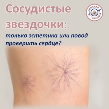 �� �������� � ���� ������ ������� ��� ����� �����, ������� �� ��������, ��������� ��� �������? ���� ����� ��� ���������� �� �����, �� ����� ������������ � �� ����, � �� �����, � �� ������