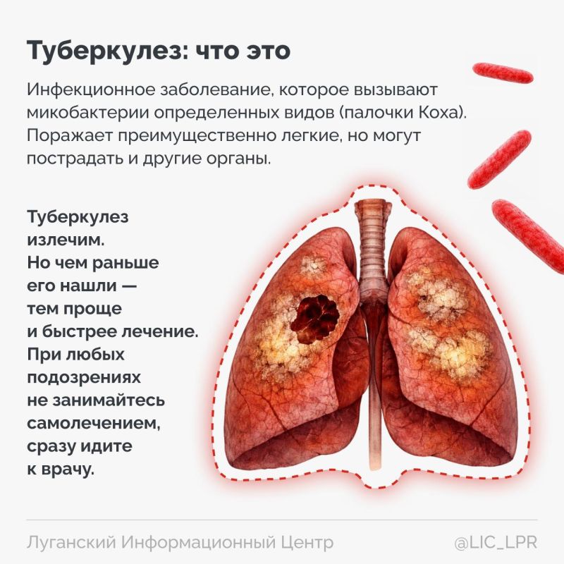 Кашель дольше трех недель, ночная потливость, беспричинная усталость — эти признаки часто списывают на простуду или стресс. Но именно они могут быть первыми сигналами туберкулеза. Поэтому нужно как можно раньше обратиться к... Кашель дольше трех недель, ночная потливость, беспричинная усталость — эти признаки часто списывают на простуду или стресс. Но именно они могут быть первыми сигналами туберкулеза. Поэтому нужно как можно раньше обратиться к...