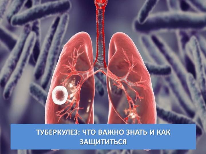 ТУБЕРКУЛЁЗ. Что нужно знать каждому: «Золотые правила»