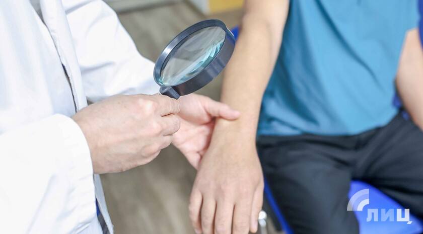 Врачи-дерматовенерологи в ЛНР стали чаще выявлять злокачественные новообразования кожи, что связано с развитием диагностики и скрининга