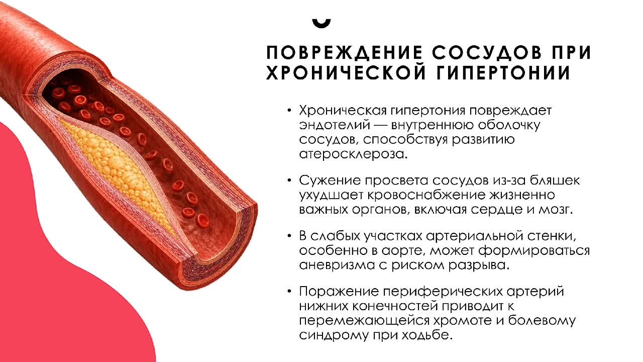 #Неделяборьбысартериальнойгипертониейиприверженностиназначеннойврачомтерапии