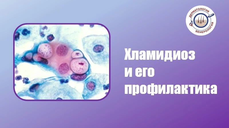 Хламидиоз — это инфекционное заболевание, вызываемое бактерией Chlamydia trachomatis