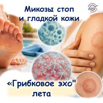 МИКОЗЫ СТОП И ГЛАДКОЙ КОЖИ: ПОЧЕМУ ГРИБОК ВОЗВРАЩАЕТСЯ СНОВА И СНОВА?