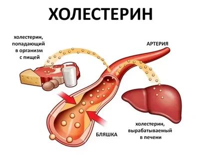 Контроль холестерина — это не просто цифры в анализах